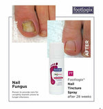 Footlogix Nail Tincture Spray 足樂適 7T 天然抗甲菌噴霧劑 （灰甲寶）