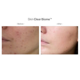 ANP-Skin Clear Biome™ 4合1排毒抗醣益生菌療程 (準專利配方) (四個月療程)