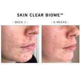 ANP-Skin Clear Biome™ 4合1排毒抗醣益生菌療程 (準專利配方) (兩個月療程)