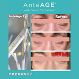 AnteAGE ® Eye 逆齡眼周修復精華