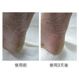 Footlogix DD cream mousse (with DIT*) 雙重防護DD泡沫 #1