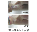 Footlogix-peeling skin formula (with DIT & Spiraleen®)香港腳配方修護泡沫 #7