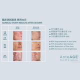 AnteAGE ® SERUM and ACCELERATOR 重生抗齡精華及重生促進液套裝