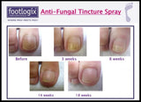Footlogix Nail Tincture Spray 足樂適 7T 天然抗甲菌噴霧劑 （灰甲寶）