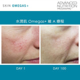 ANP-Skin Omegas™ (Triple Pack) 水潤肌 Omegas+ 維 A 療程  (3個月療程裝)