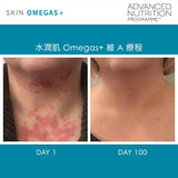 ANP-Skin Omegas™ (Triple Pack) 水潤肌 Omegas+ 維 A 療程  (3個月療程裝)